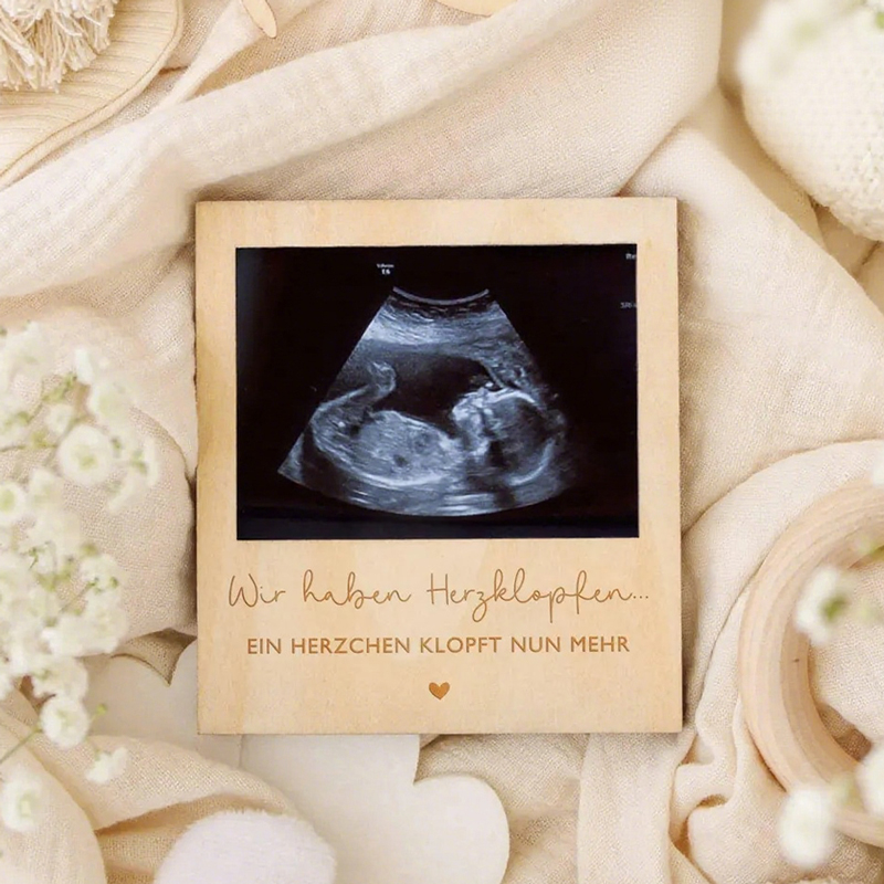 Ultrasound Pregnancy Announcem - Photo Booth Frame ulasan dan harga